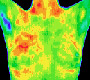 Why So Many Mammograms?